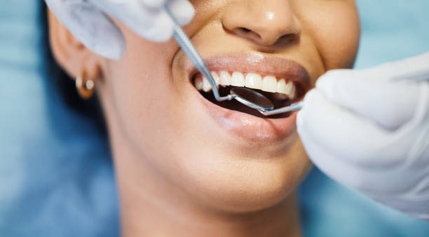 Best Walk-In Emergency Dentist in Seatac, WA
